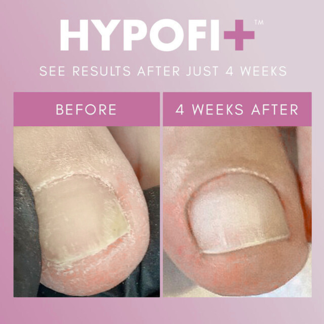 TheGelBottleSerum|NAIL MALL BEAUTY SUPPLY